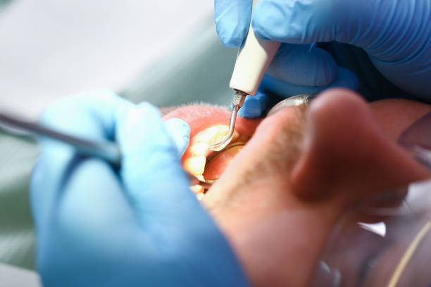 Best Emergency Dental Services for Seniors in Seat Pleasant, MD